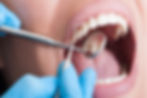 5280 Teeth Whitening