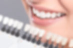 teeth whitening